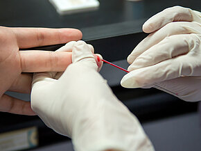 Hepatitis-C-Schnelltest Der Hepatitis C-Schnelltest ist ein Antikörper-Suchtest. Benötigt wird dafür nur eine kleine Menge Blut, die aus der Fingerkuppe entnommen wird.